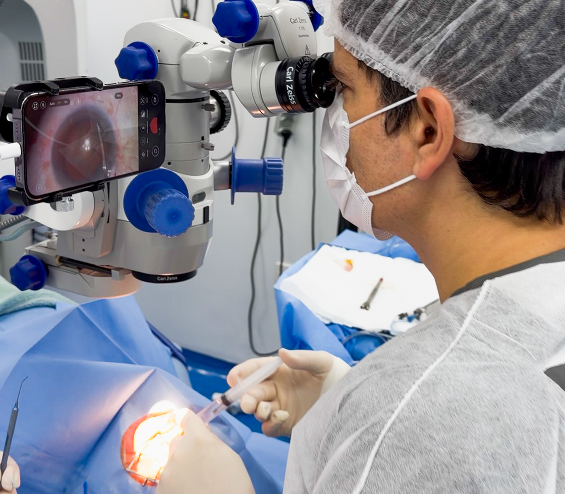 Cirurgia de Catarata